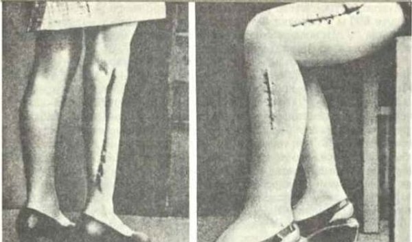 Опыты с антибиотиками