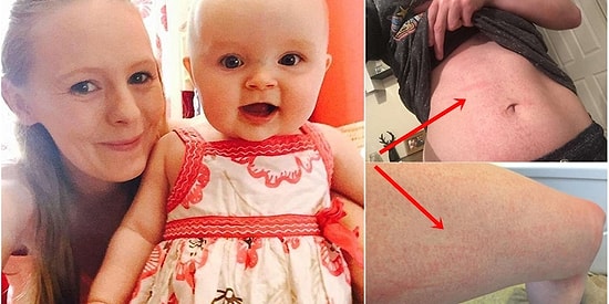 Su Bile İçemiyor! Hamilelikte Hormonların Değişmesi Nedeniyle Suya Alerjisi Başlayan Annenin Hikayesi