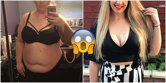 Kendisine Konulan Polikistik Over Sendromu Tanısından Sonra İnanılmaz Bir Değişime Uğrayan Kadın: Katie Webber