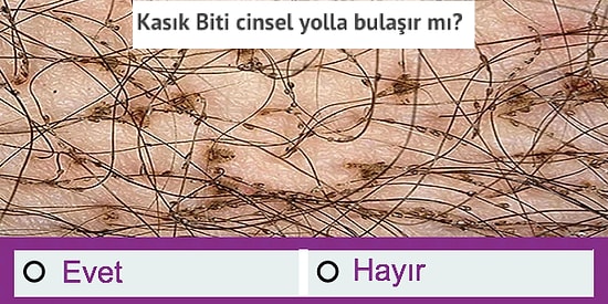 Hangi Hastalıkların Cinsel Yolla Bulaştığını Biliyor musun?