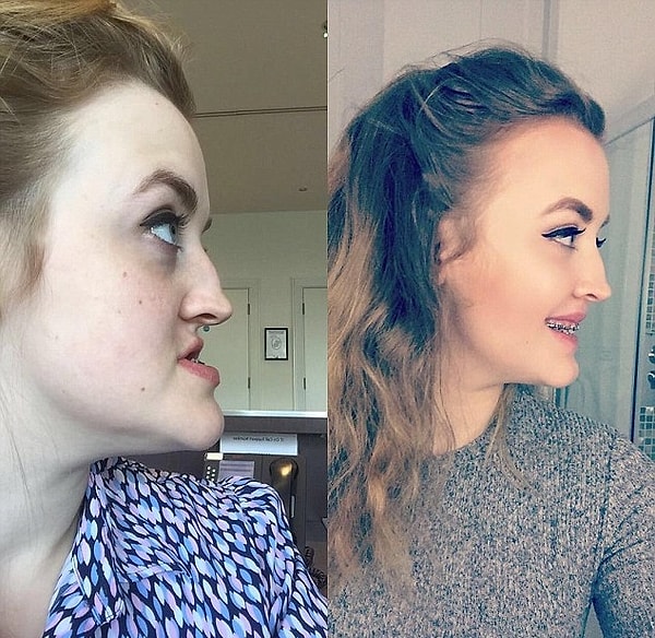 Такое отношение было не только у ровесников, но и у обычных прохожих на улице - ее обзывали питбулем