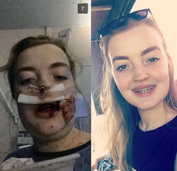 Ребекка потеряла много крови, а боли после операции были невыносимы