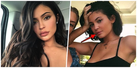 Eski Haline mi Dönüyor? Kylie Jenner Dudak Dolgusunu Çıkarttırdı, Yeni Görüntüsüyle Herkesi Şok Etti!
