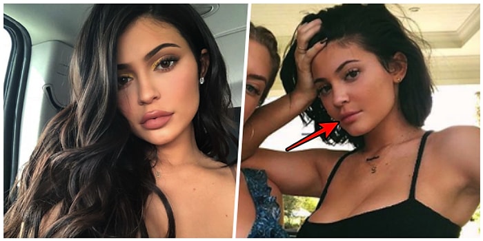 Eski Haline mi Dönüyor? Kylie Jenner Dudak Dolgusunu Çıkarttırdı, Yeni Görüntüsüyle Herkesi Şok Etti!