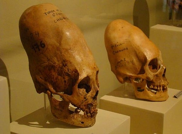 1. Uzaylılara ait olduğu iddia edilen Paracas kafatasları