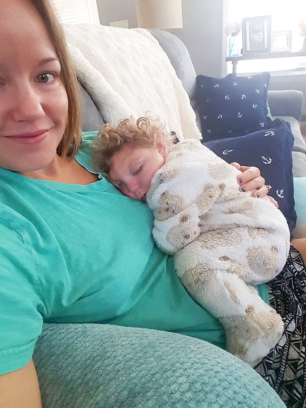 1. Этот малыш родился без значительной части мозга.