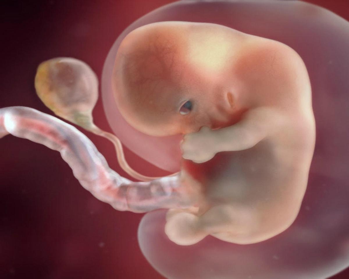 Как выглядит ребенок на 8 неделе. Эмбрион на 8 неделе беременности. Зародыш на 8 неделе беременности. 8 Недель беременности фото.