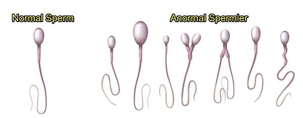 4. Bütün sperm hücreleri düşünüldüğü gibi aynı şekilde değildir.