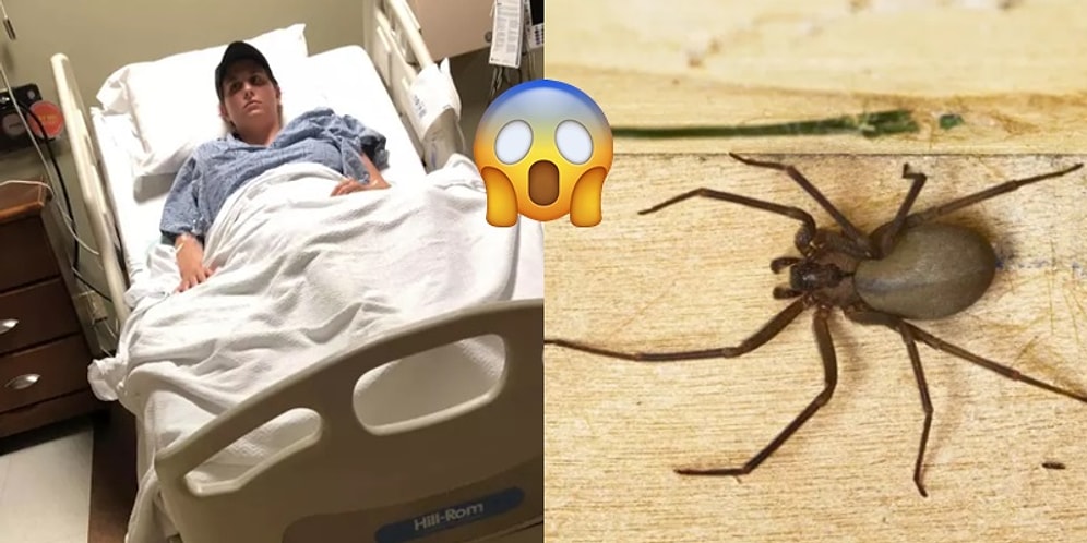 Örümcek Saldırısından Sonra Akciğerinde Oluşan Kan Pıhtıları Dolayısıyla Ölümden Dönen Kadın