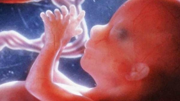 Hamileliğin 11. haftasında bebeğinizi ultrasonda daha net görebilirsiniz.