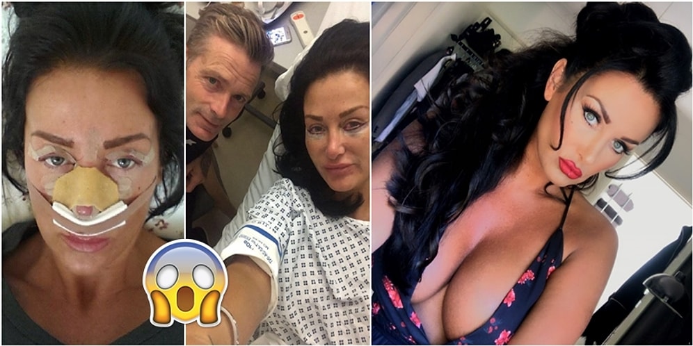 Tabutunda Güzel Görünmek İçin Ameliyatlara 600.000 TL Para Harcayan Estetik Bağımlısı Kadın