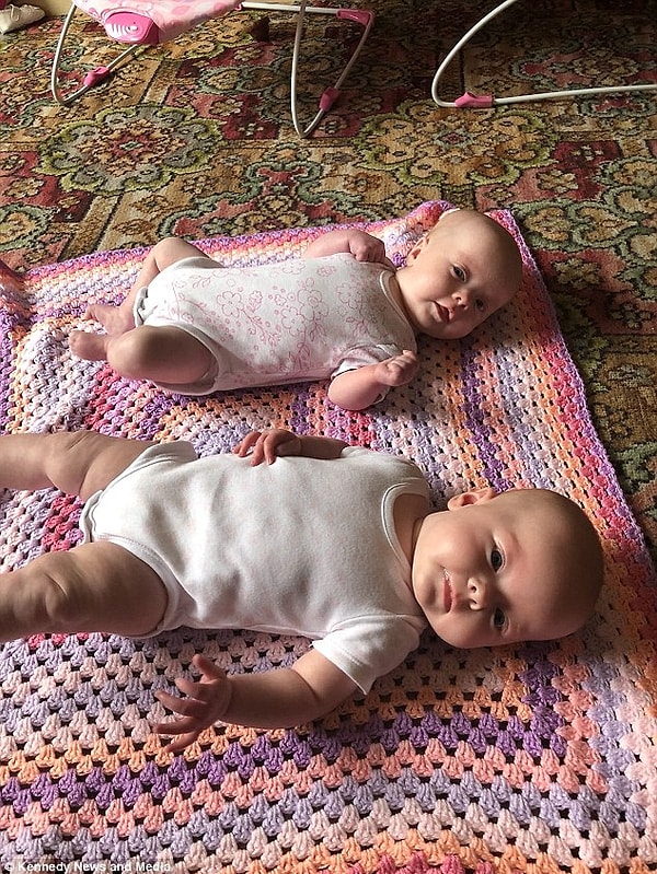 5. До родов Бэмфорд неоднократно наведывалась к доктору из-за плохого самочувствия, но врач не смог понять, что его пациентка беременна.