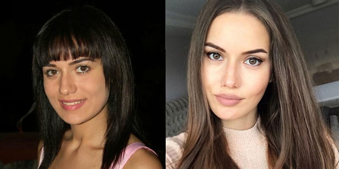 Gelecekte Hangi Estetik Ameliyatını Yaptıracaksın?