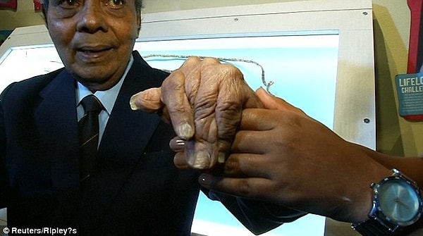 7. Из-за огромной длины и веса ногтей Чиллал не мог пользоваться левой рукой: он был неспособен раскрыть ладонь или вытянуть пальцы.