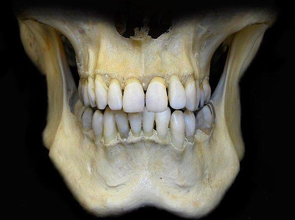 13. Bu haberle de tıbbın gelişmesine şükrediyoruz. Orta Çağ’da ölü askerlerin dişlerinden protezler yapılırdı.