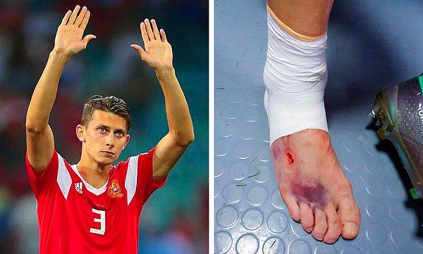 17. Ilya Kutepov, 2018 Dünya Kupası sırasında 100 dakika boyunca sakat haliyle oynadı.