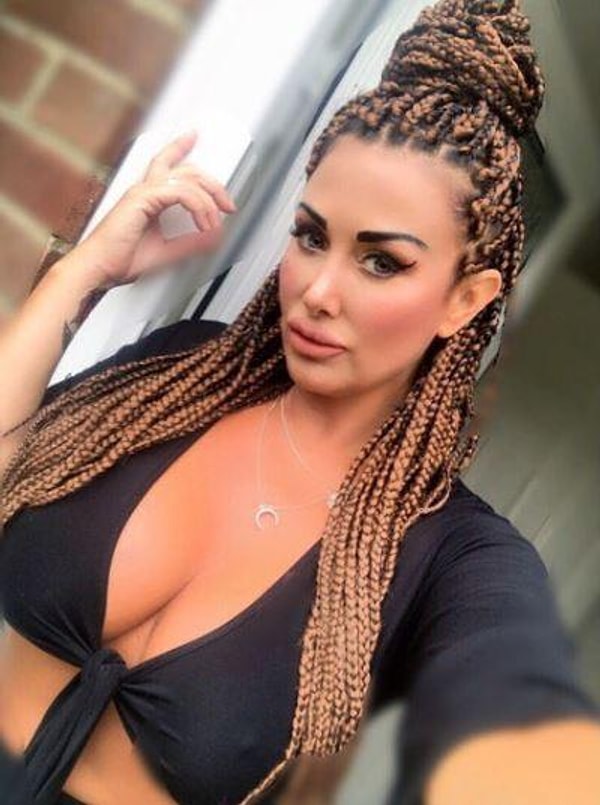 Айми, которая говорит, что единственное время, когда она не испытывает боли, это время на хирургическом столе, теперь постоянно живет с болеутоляющими средствами.