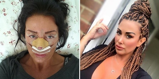 История об очередной любительнице пластики, не пожалевшей на свою красоту 130 000$!