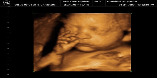 Hamilelikte 16. Hafta: Bebeğiniz Artık Yüz İfadeleri Yapabiliyor!