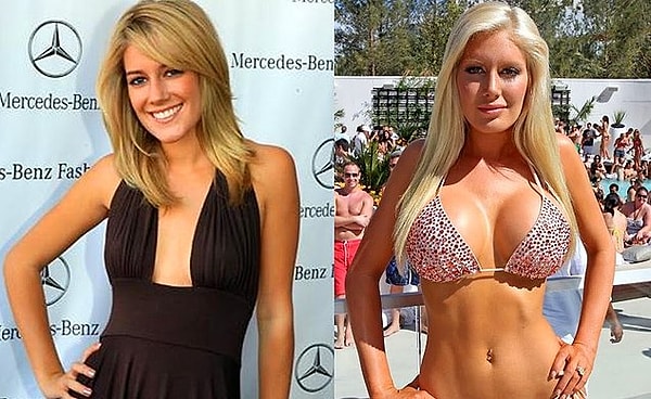 Пластика груди!