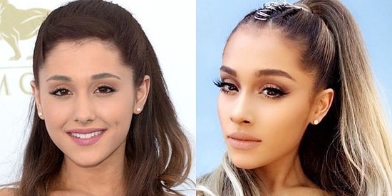 Тест: Какая пластическая операция ждет тебя в будущем?