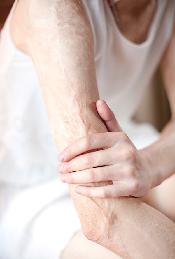 4. Платье было кружевным, поэтому оно начинало гореть довольно медленно. Но затем в один момент оно все занялось огнем, вспыхнув, и охватило все тело маленькой Светы.