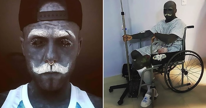 Тату-фрик из Калининграда удалил себе половой орган, потому что «он не вписывался в его внешний вид»