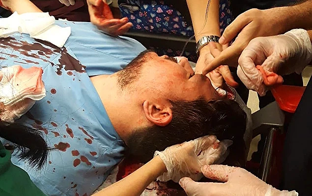 'Ben sadece arkadaşımı korumaya çalıştım'