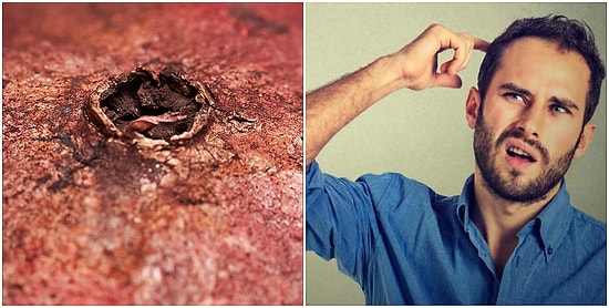 Тест: Угадайте, что изображено на макрофотографии