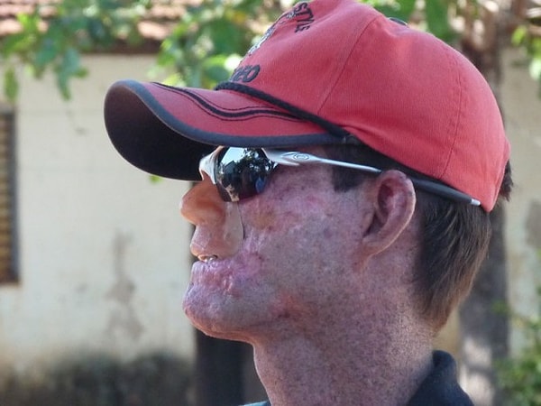 1. Арарас - бразильская деревня, в которой люди не переносят солнца