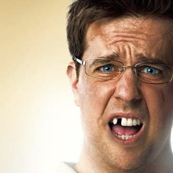 12. У звезды «Мальчишника в Вегасе» Эда Хелмса действительно не хватает зуба. Ему вставили имплантат еще в подростковом возрасте, а для фильма дантист его снял.