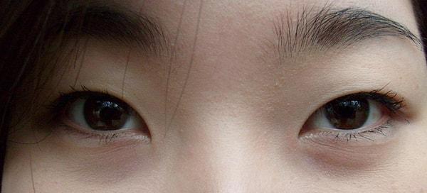 15. Çinlilerin gözleri neden çekiktir?
