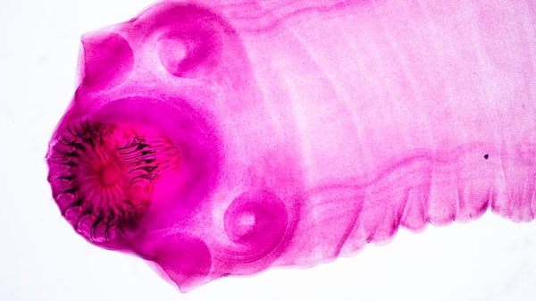 7. Проглатывание ленточного червя для похудения