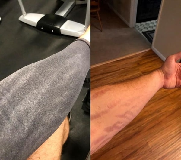 6. Парень потеет ровно по своим шрамам...