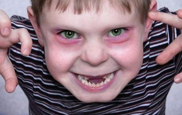 10. Болезнь с каким названием действительно существует?