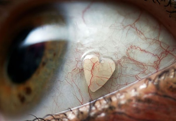 4. На выбор предлагается сердечко и звездочка из платины. Почему именно из платины? Потому что на другие металлы у пациентов может быть аллергия.