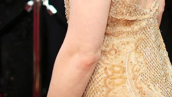 4. Кому принадлежит этот локоть?