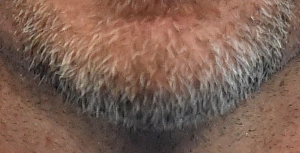 5. Кто является обладателем этого мужественного подбородка?