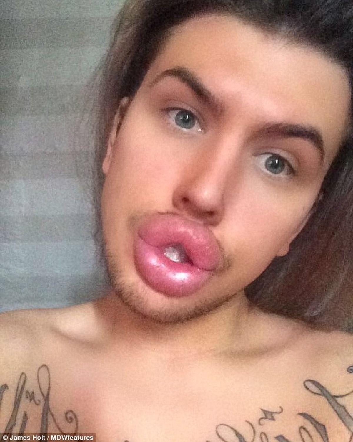 Муклы дягилева. Огромные накрашенные губы. Страшные силиконовые губы. Очень сильно большие губы. Очень сильно большие губы.