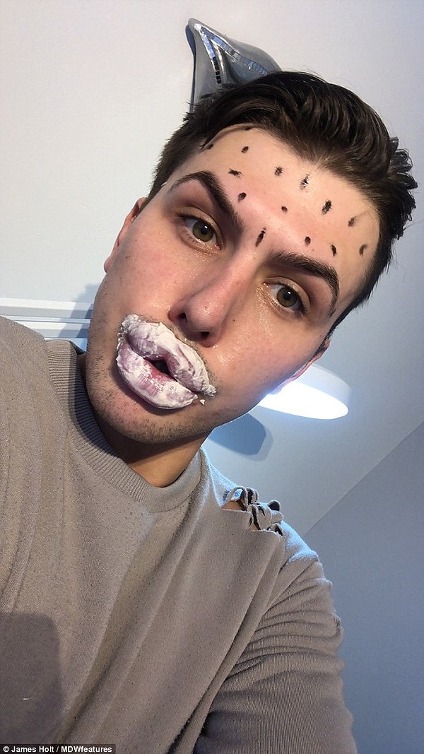 Как видите, изменились не только губы, но и форма носа, и многое другое.