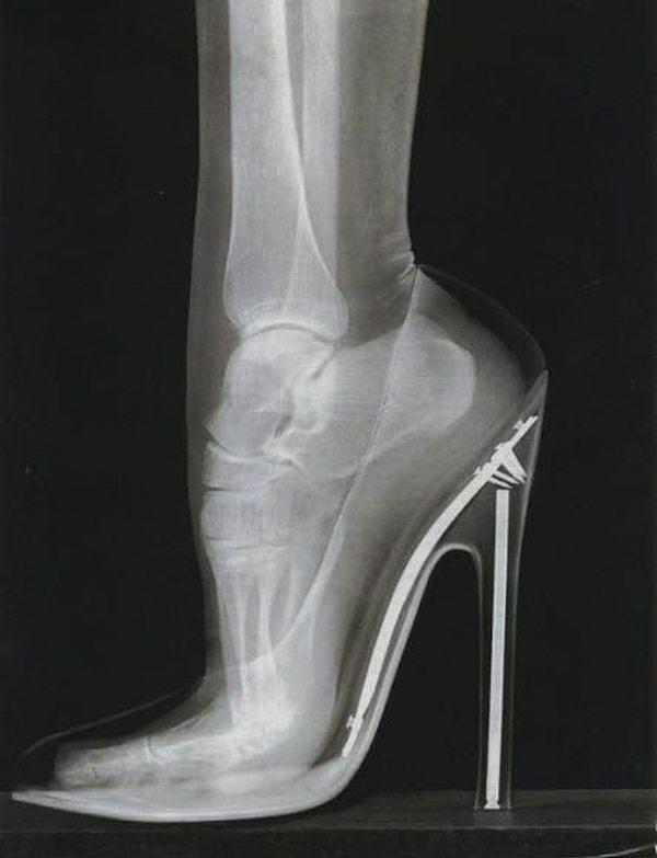 7. Evet kadınlar topuklu ayakkabı giydiğinde ayakları bu şekilde duruyor. 😏