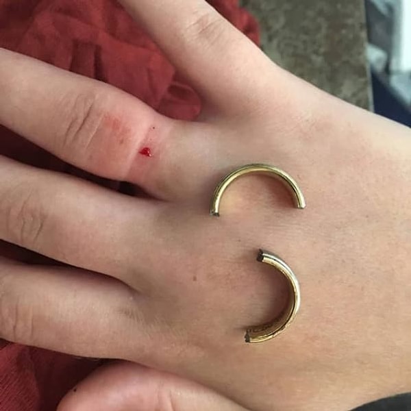 10. У кольца этой будущей мамы наконец лопнуло терпение.