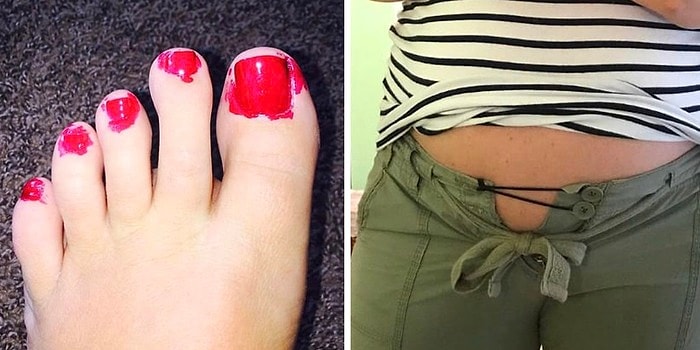 Как будто огромного живота мало! Беременные женщины, которым приходится несладко