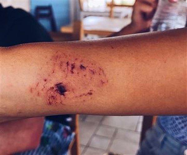Bir anda köpek balıklarından biri kıza saldırdı, kolunu yakaladı ve onu suyun altına çekmeye başladı.