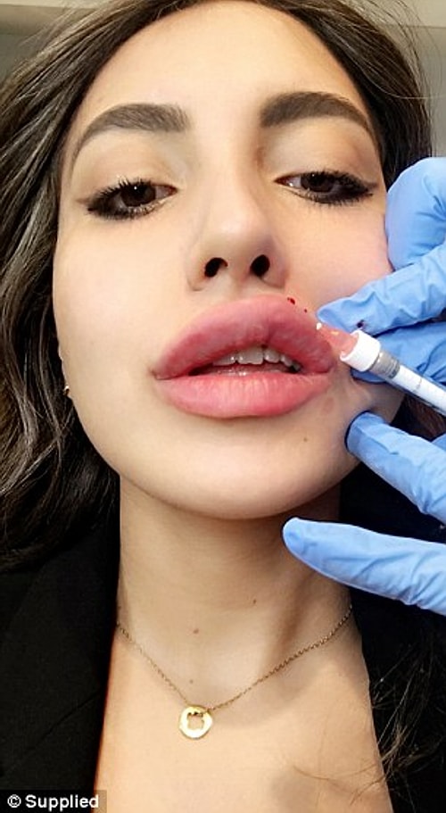 Dünyanın en büyük kozmetik cerrahlar grubu, Amerikan Plastik ve Rekonstruktif Cerrahi Akademisi de 'selfie' modasının farkında olduğunu açıkladı.