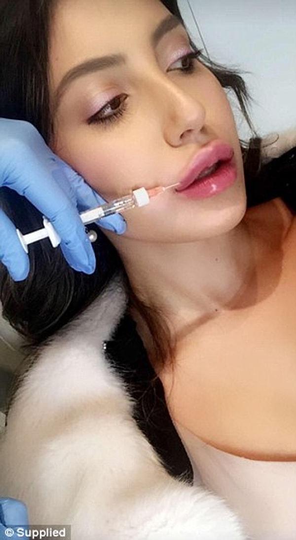 Dünyanın en büyük kozmetik cerrahlar grubu, Amerikan Plastik ve Rekonstruktif Cerrahi Akademisi de 'selfie' modasının farkında olduğunu açıkladı.