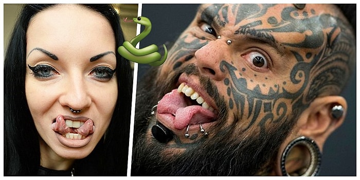 Язык "ящерки": британские врачи предупреждают, что такого рода пластические операции могут закончиться летальным исходом