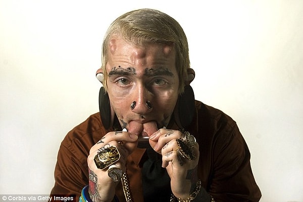 Самые известные хирурги мира критикуют молодых людей, решающихся на этот шаг.