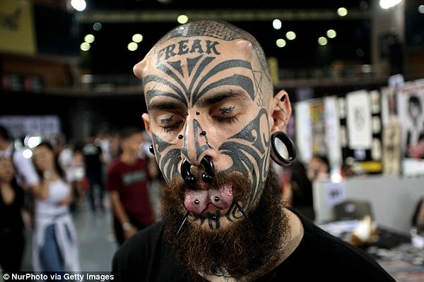 Дэвид Ворд: "Ни один уважающий себя хирург не пошел бы на эту операцию, поскольку риск велик как во время её проведения, так и после"