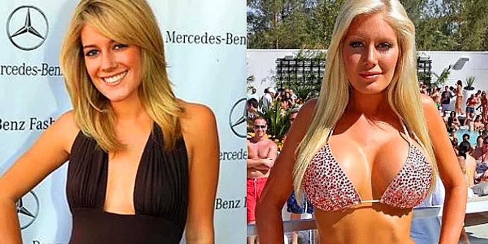 Silikonların Gücü Adına! Estetik Operasyon Sayesinde Başka Birine Dönüşen 15 Ünlü